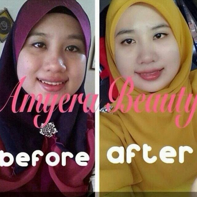 Amyera Beauty Skincare Beauty Personal Care Face Face Care On Carousell