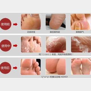 [OFFER!!] 2 Boxes Japanese Exfoliating Foot Mask