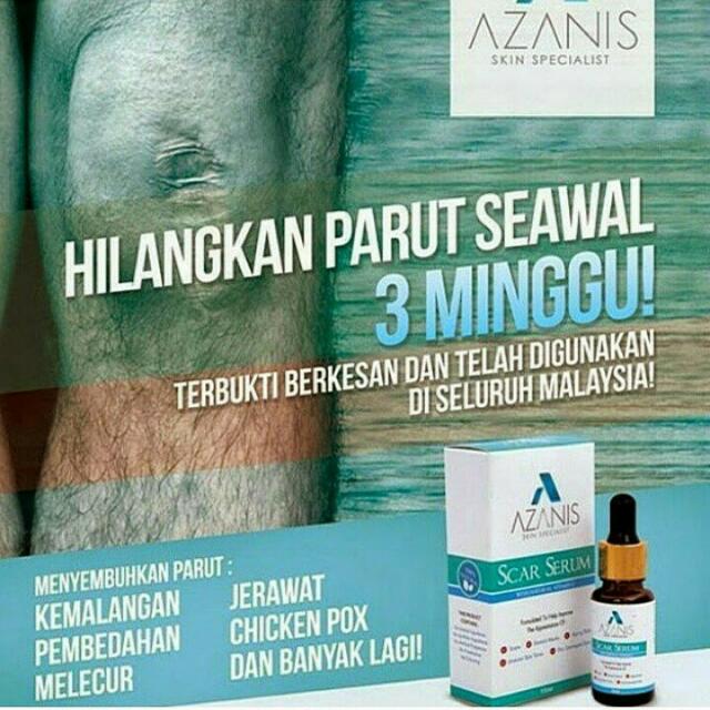 Azanis Scar Serum New Old Packaging Health Beauty On Carousell