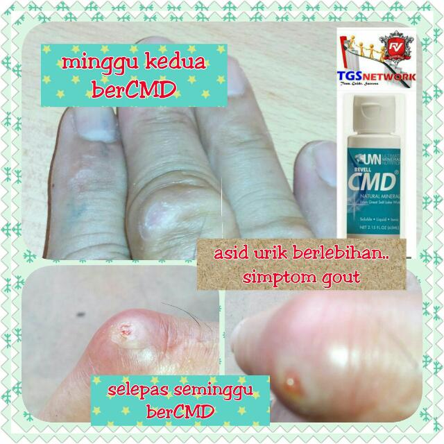 CMD- Concentrated Mineral Drops, Beauty & Personal Care, Bath & Body ...