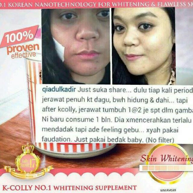 K Colly Sweet 17 Collagen Instock Beauty Personal Care Face Face Care On Carousell