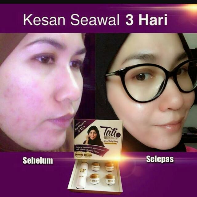 kelebihan tati skincare