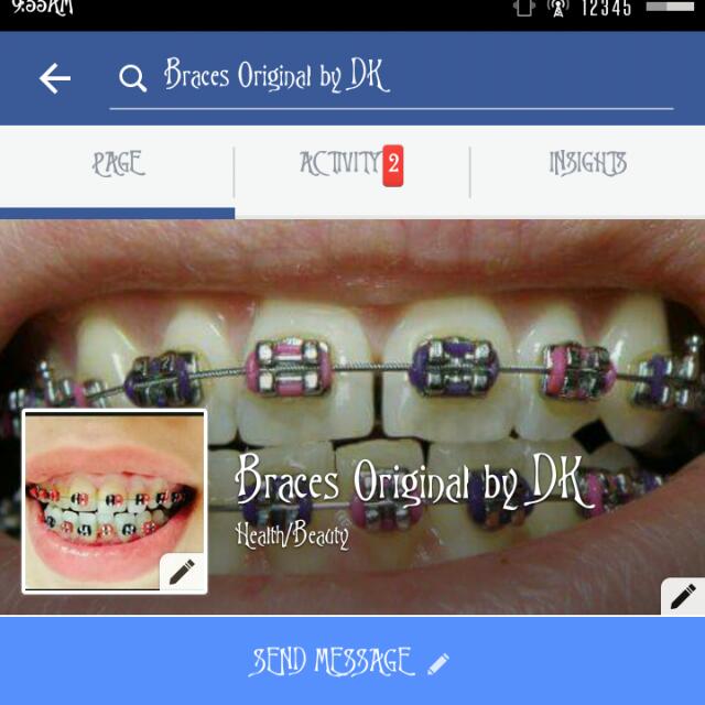 BRACES RM 850, Women's Fashion, Jewelry & Organisers, Body Jewelry on ...