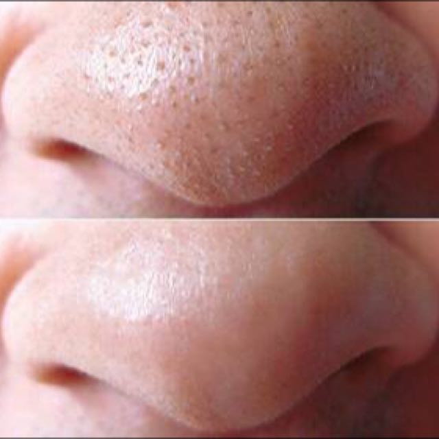 VIETNAM BLACKHEAD REMOVAL PORESTRIP (GEL MAT NA HUT MUN WHITE) , Beauty