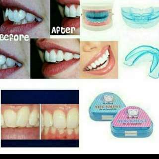 Affordable Teeth Alignment For Sale Women S Fashion Carousell Malaysia