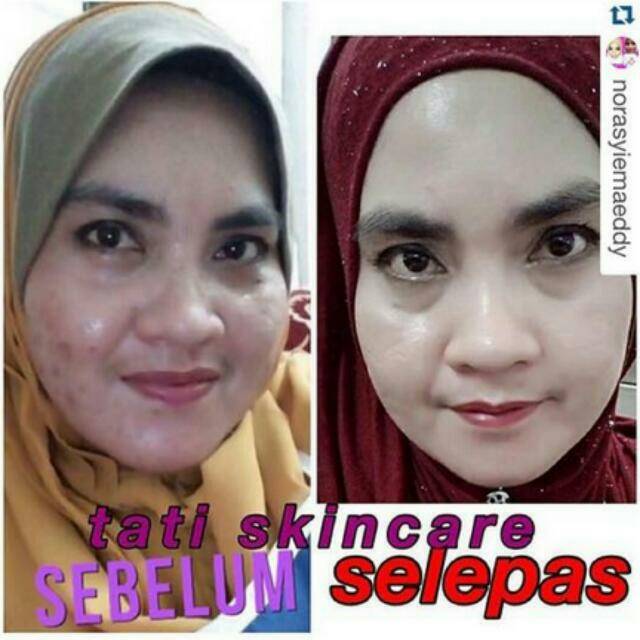 kelebihan tati skincare
