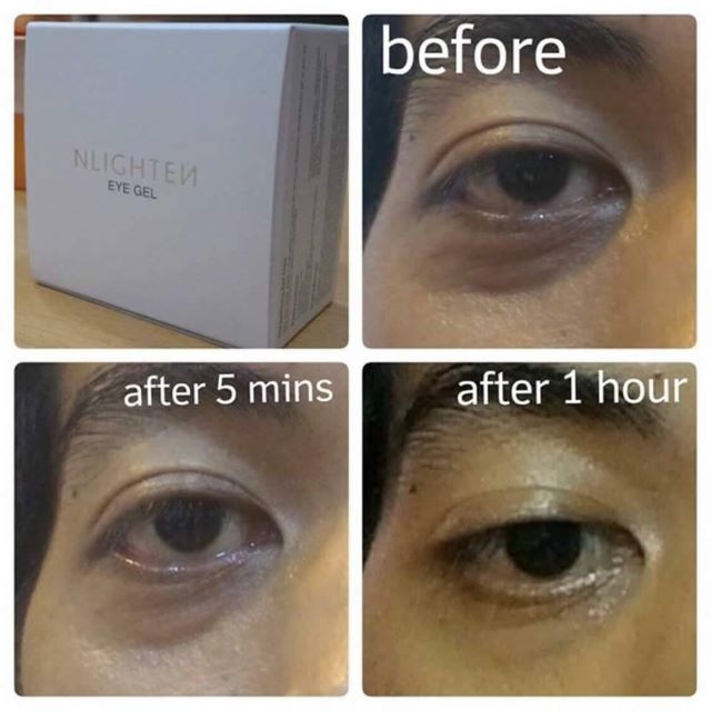 3 in 1 Korean made eyebags and dark eye circle remover, and reduce