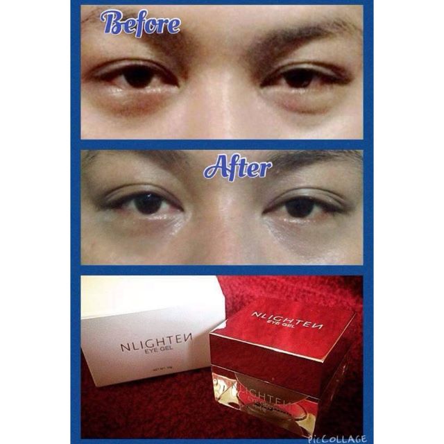 3 in 1 Korean made eyebags and dark eye circle remover, and reduce