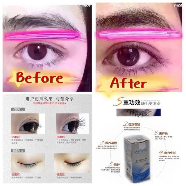 Miraclash shop