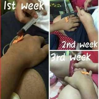 Skin Whitening