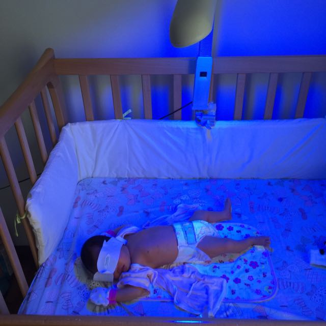 Blue Light Phototherapy For Baby Jaundice, Babies & Kids, Nursing