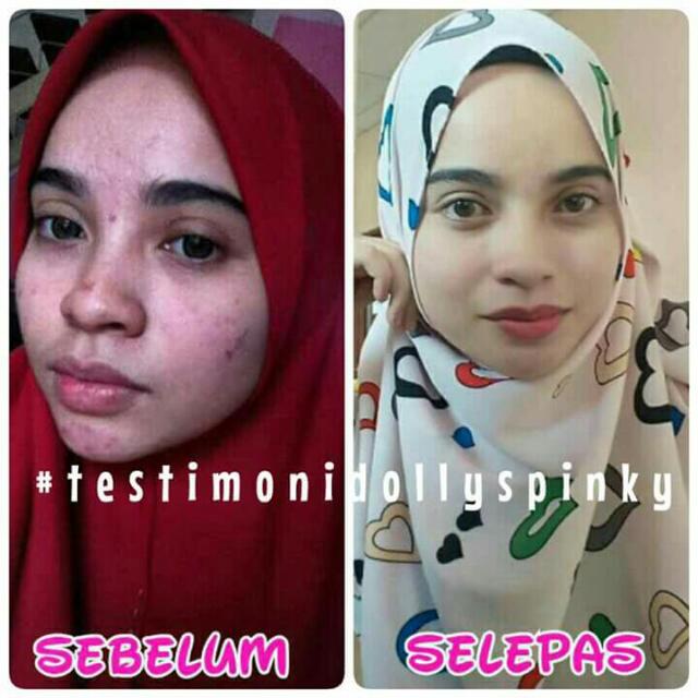 Dollys Pinky, Beauty & Personal Care, Bath & Body, Bath on Carousell