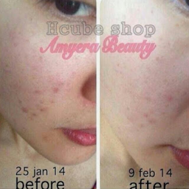 Amyera Beauty Flawless Skincare Preorder Items Duration Estimated 7 10working Days Processing Proceed Upon Full Payment Received Via Bank Transfer Thank You Hobbies Toys Memorabilia Collectibles Stamps Prints On Carousell