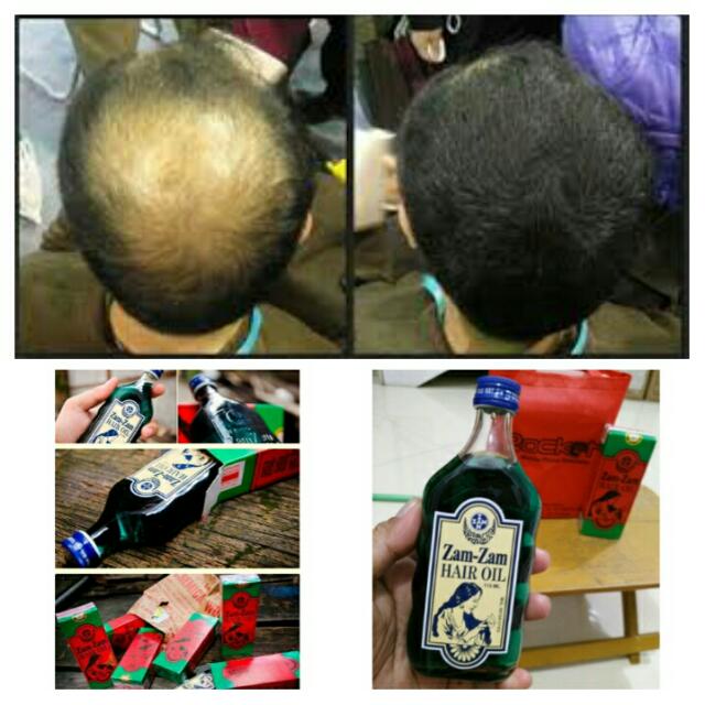 Zam Zam Herbal Hair Oil Anti Hair Loss Growth Nourishes Vitamin