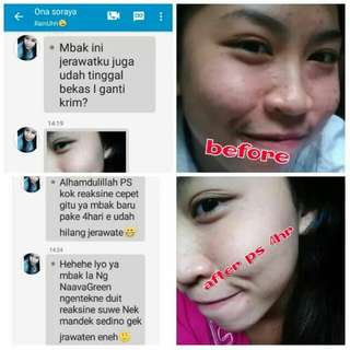 Cream Pesona Solo