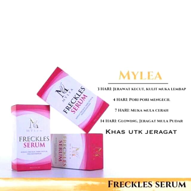 Freckles Serum Mylea Serum Jeragat Health Beauty Skin Bath Body On Carousell