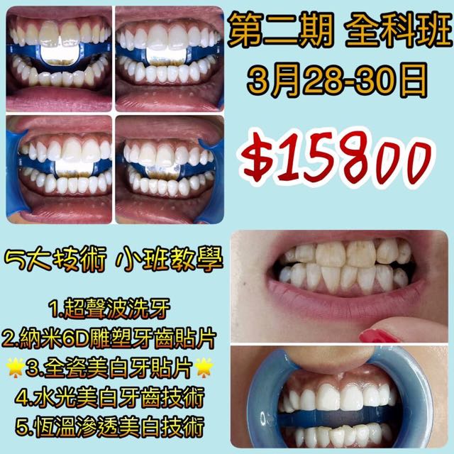 （分類：）位於 。 由 ting_yo 提交（商品編號 92725570，圖片 1）。簡介： 。