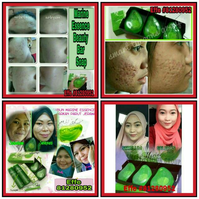 Marine Essence Beauty Bar Soap Health Beauty Bath Body On Carousell