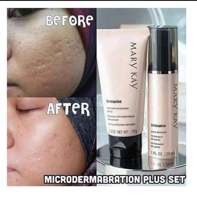 Testimoni Mary Kay Timewise Microdermabrasion Plus Set Health Beauty Skin Bath Body On Carousell