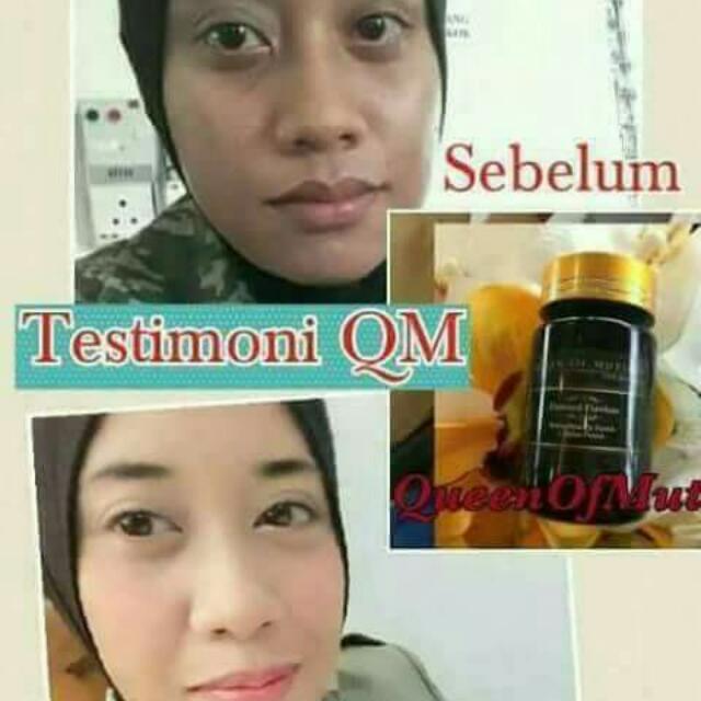 Queen Kapsul Mutiara 30 Biji Rm55 Health Beauty Skin Bath Body On Carousell