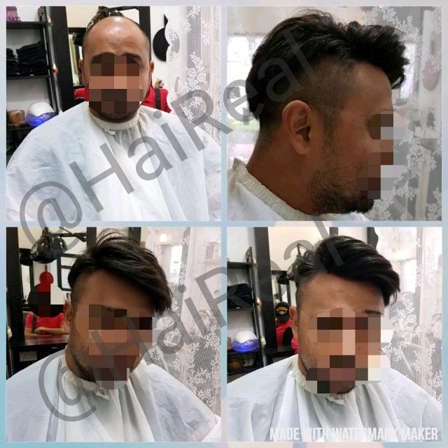 Hair Replacement System New Suitable For Thinning Hair Hair