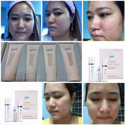 Atomy Evening Care 4 Set Cleans Remove Dullness From Deep Within Pores Korea Beauty Personal Care Face Makeup On Carousell