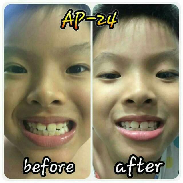 ap 24 reviews by dentists