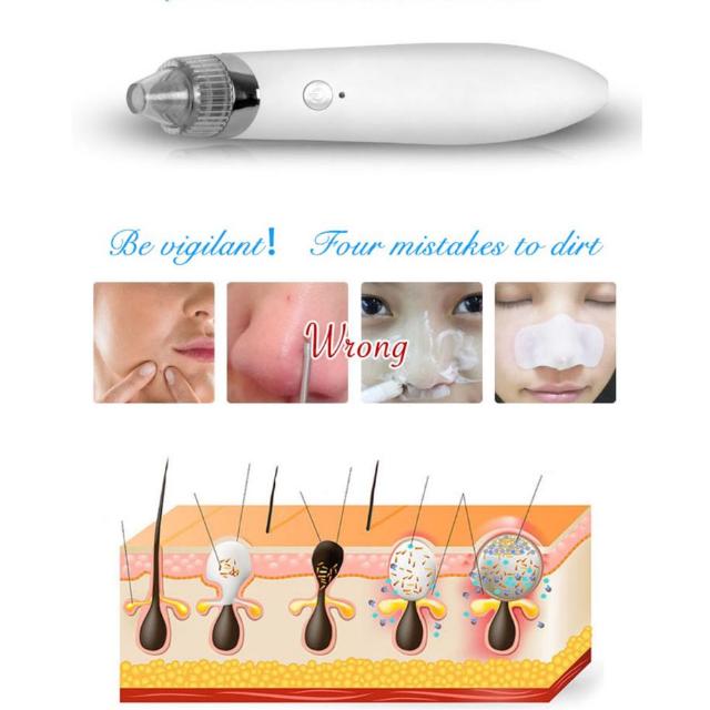 Comedo Vacuum Cleanser Suction Rt 8080 Health Beauty Bath Body Comedo Vacuum Cleanser Suction Rt 8080 Health Beauty Bath Body On Carou