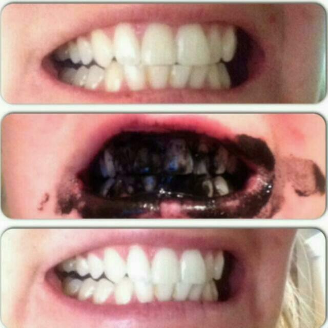 1 + 1 + 1 + 1 = 4 Items ! Activated Charcoal Teeth Whitening Powder  Toothpaste + 1 Free toothbrush + Coconut Oil + Teeth Whitening Strip! Value  Pack [ Restock ], Health & Beauty, Bath & Body on Carousell