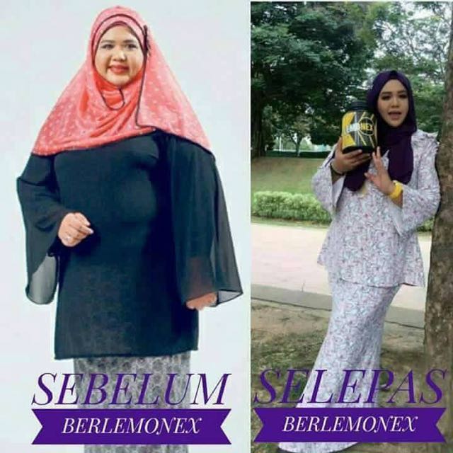 Lemonex Minuman Kurus Health Beauty Skin Bath Body On Carousell