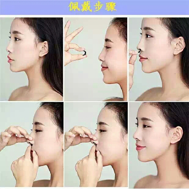 Rhinoplasty 3d High Increased The Nose Stealth Set Health
