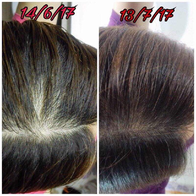 Set Perawatan Rambut Gugur Produk Badan dan kecantikan Set Perawatan Rambut Gugur Produk Badan dan kecantikan