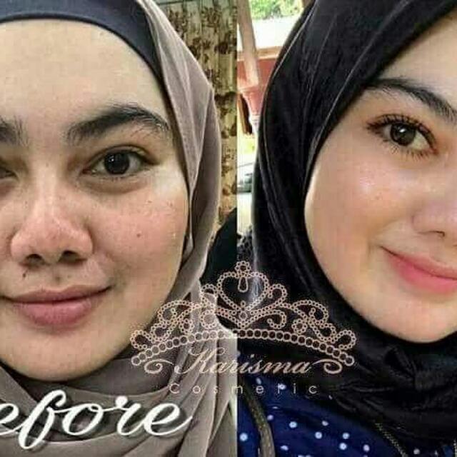 karisma skin care