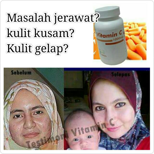 Vitamin C Pahang Pharma Health Beauty Skin Bath Body On Carousell