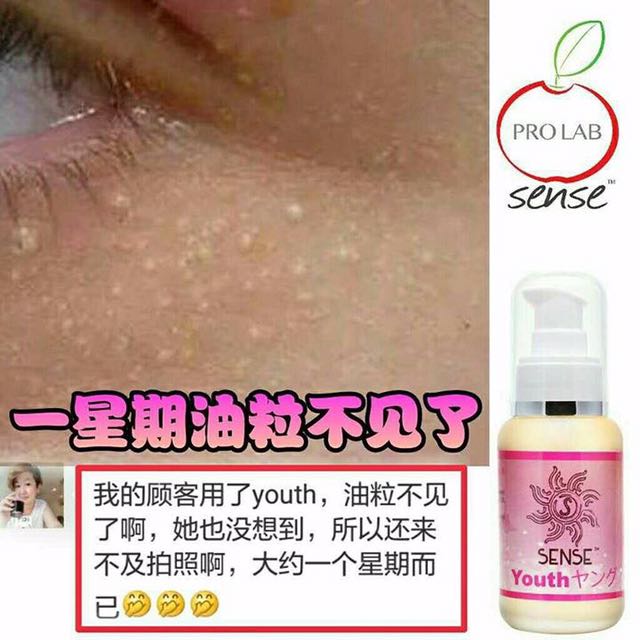 2 Btls Youth Japan 去肉粒改善祛斑改善黑眼圈皮肤敏感宝宝奶藓红肿蚊子叮咬风膜眼睛下垂祛皱纹颈纹孕妇小孩老人可用 Beauty Personal Care Bath Body Body Care On Carousell