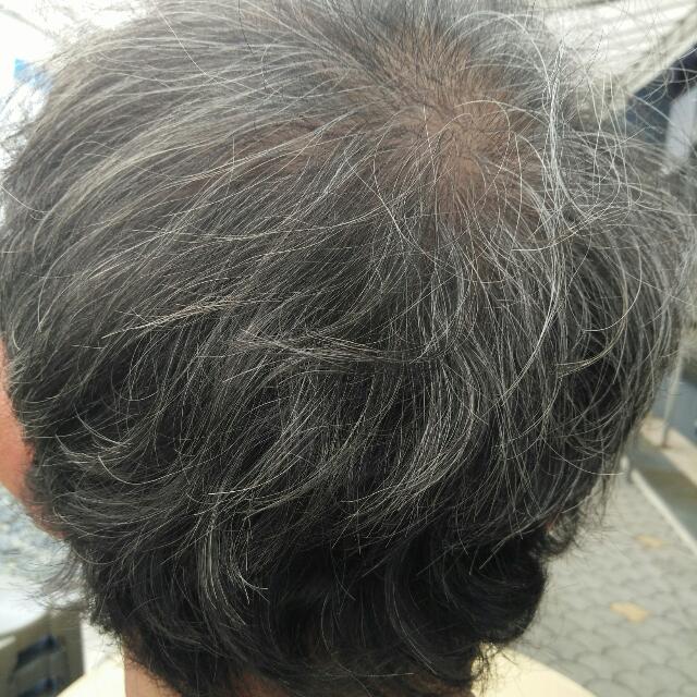 Gray Hair To Black Hair With Natural Remedy Health Beauty Hair