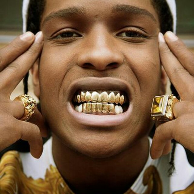 Grillz Gold Teeth Men S Fashion Accessories On Carousell