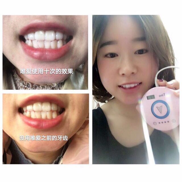 Viaila Teeth Whitening Kit Health Beauty Skin Bath Body On Carousell