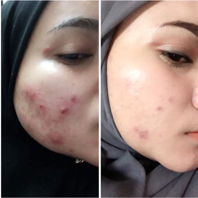 Bougas Beauty Serum Health Beauty Skin Bath Body On Carousell