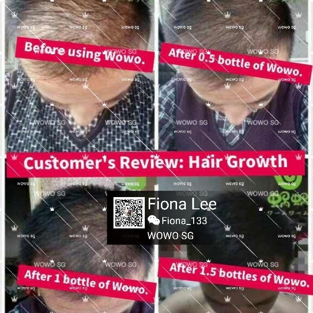 Pure Ginger Shampoo For Hair Loss Oily Itchy Scalp Health