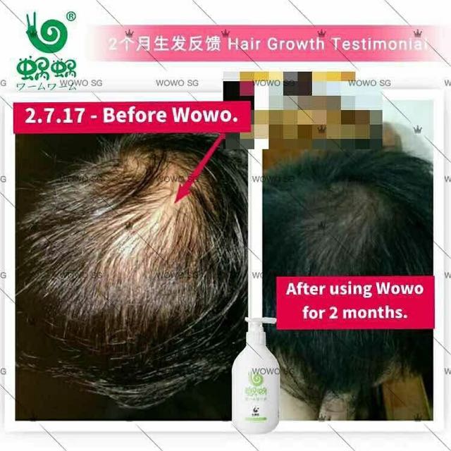 Wowo Ginger Shampoo Health Beauty Hair Care On Carousell