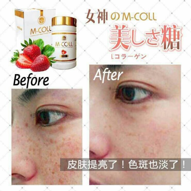 ã€ŒM COLLã€çš„åœ–ç‰‡æœå°‹çµæžœ
