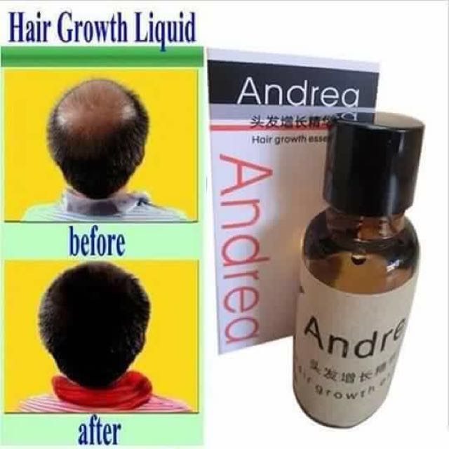 ANDREA HAIR GROWTH ESSENCE , Beauty & Personal Care, Hair on Carousell