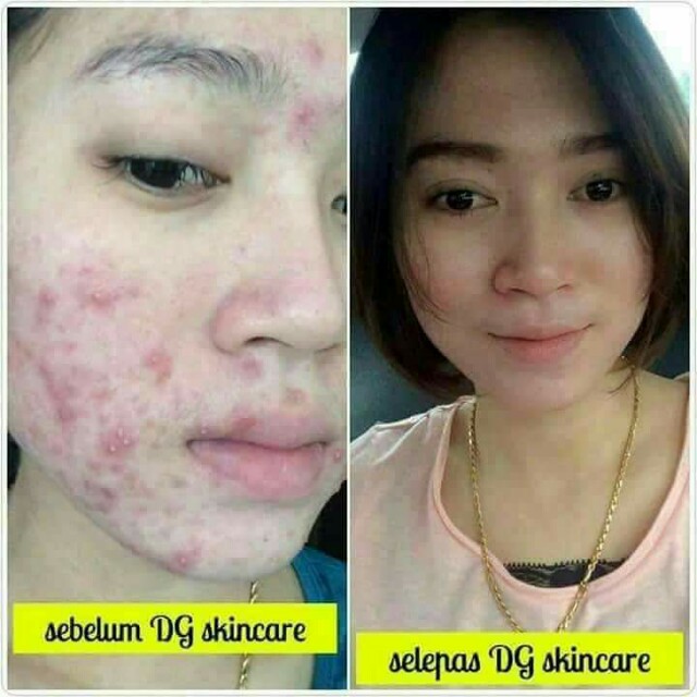 Diamond Gold Skincare Health Beauty Skin Bath Body On Carousell