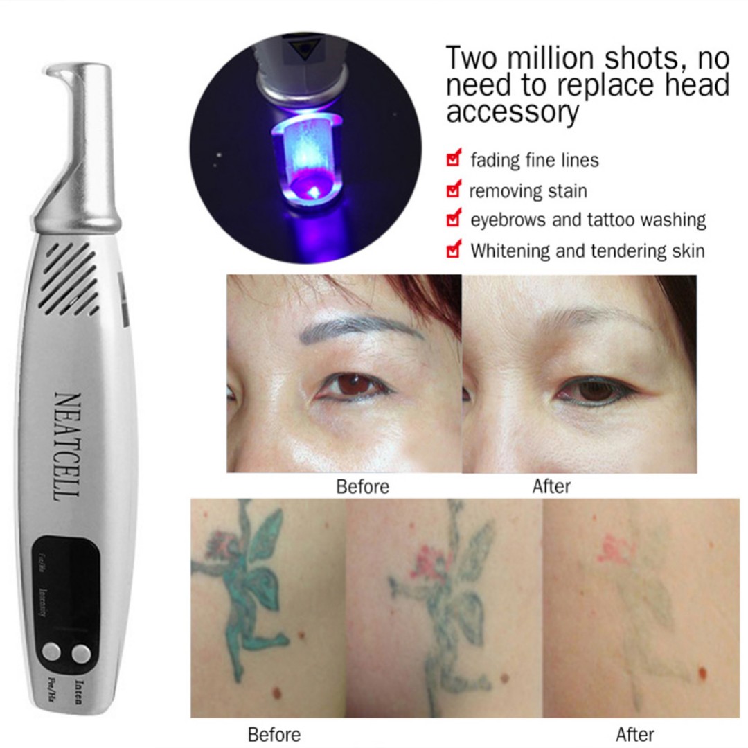 Laser Pen Light Therapy Tattoo Scar Mole Freckle Removal Dark Spot Remover Machine Skin Care Beauty Device Us Plug Health Beauty Bath Body On Carousell