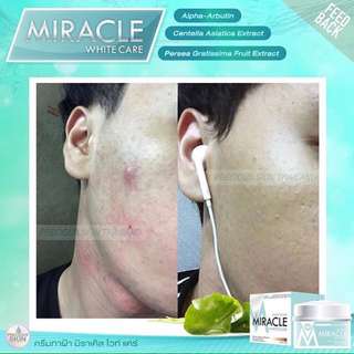 MIRACLE WHITE CARE(CREAM PENGHILANG FLEK HITAM)