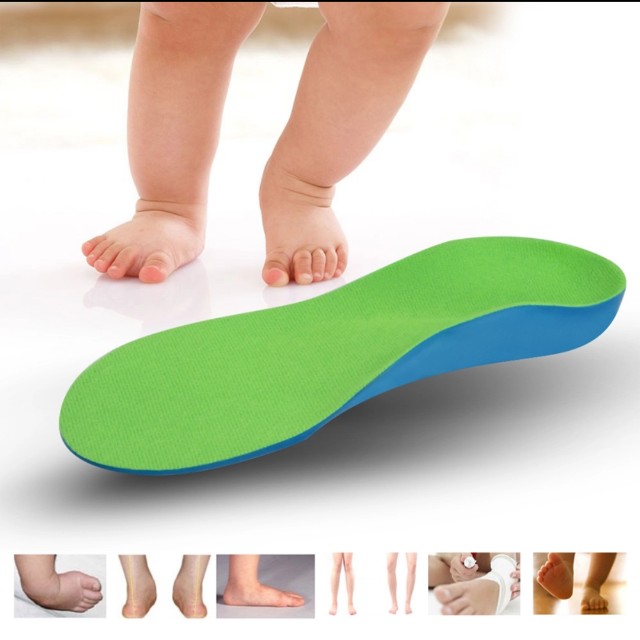 flat foot pada bayi