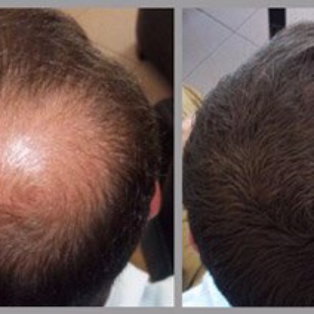 Caboki hair building fibers, Men's Fashion, Tops & Sets, Sleep and