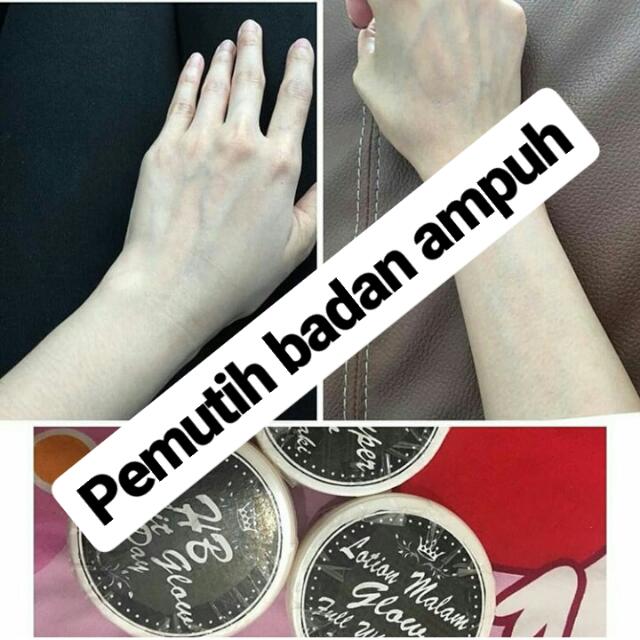 Yakin Gamau Putih Bening Kya Suntik Putih Kya Infus Whitening Yg Artis2 Gunakan Alami Kok Cuma
