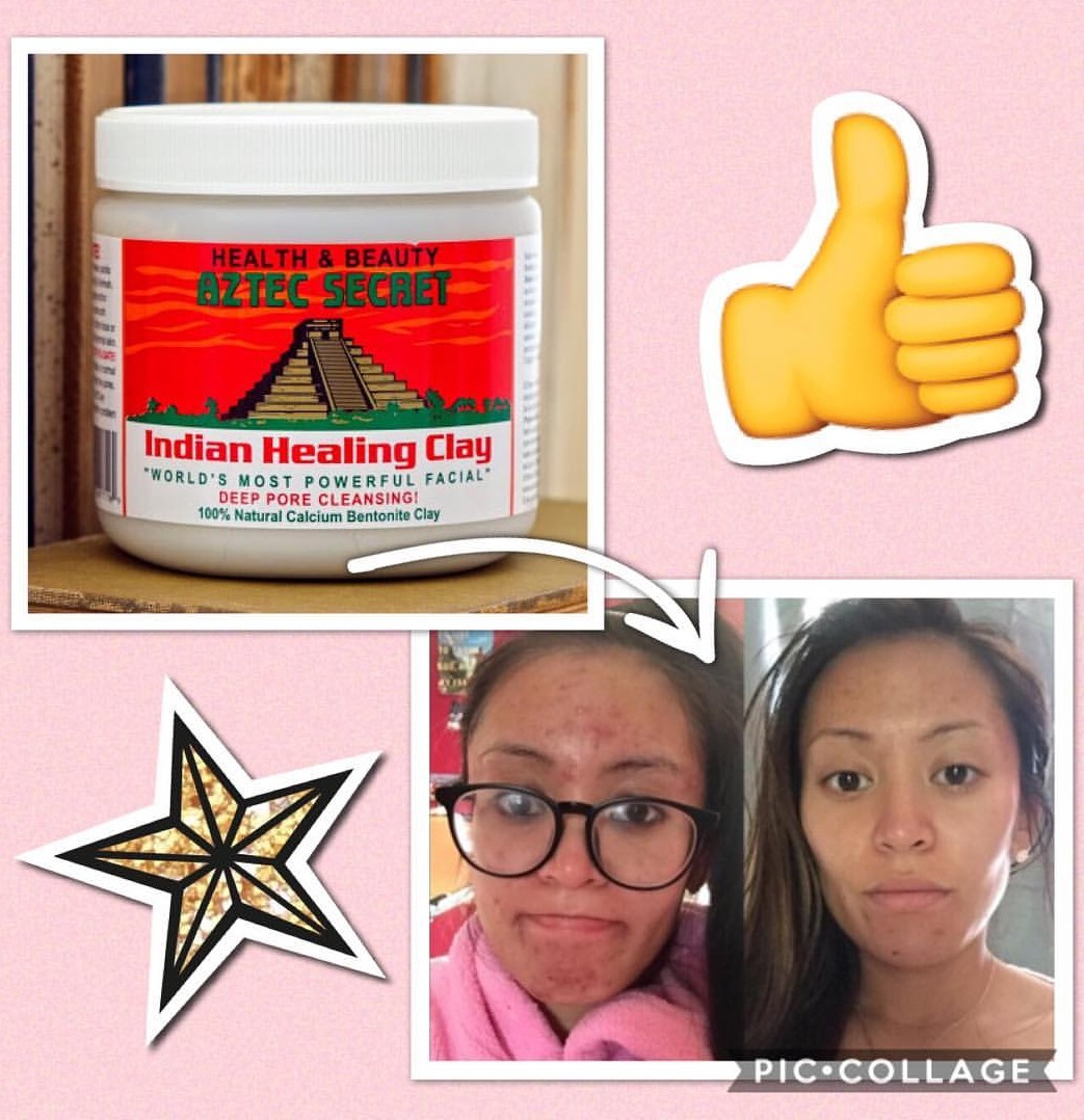 Aztec Secret Indian Healing Clay Mask & Bragg Organic Apple Cider